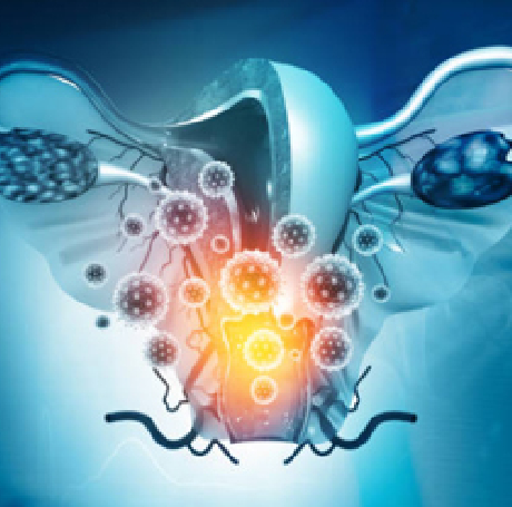 Enfermedades de transmisión sexual